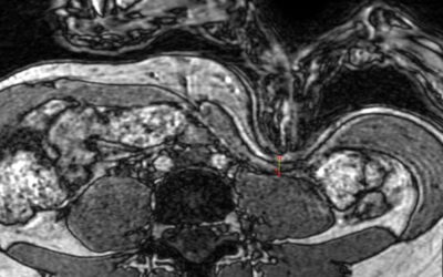 Thinking Practitioner Podcast, Ep 159: Can You Really Palpate the Psoas? (with Christopher DaPrato)